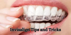 Invisalign Tips and Tricks